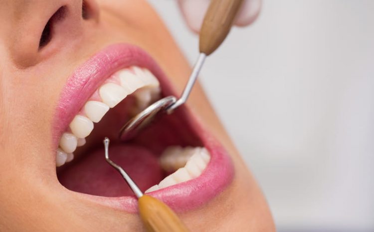  Limpeza Dental Campinas – 5 Dicas