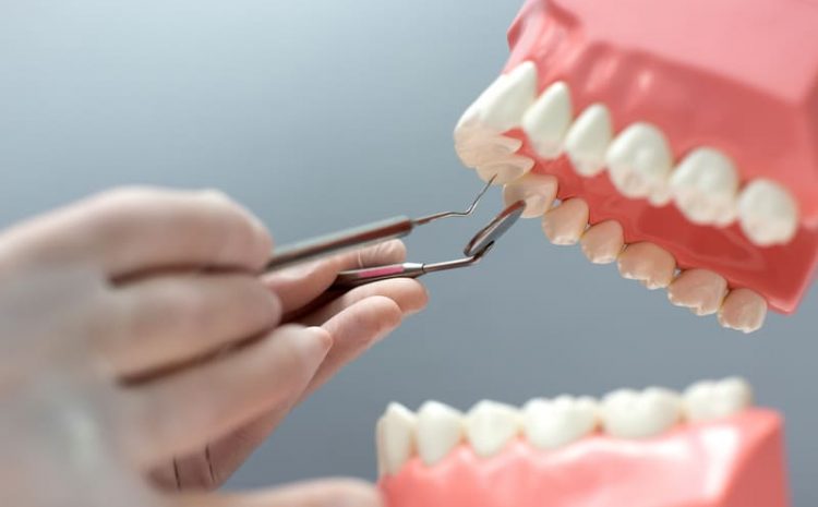  Quais são os Nomes dos Dentes ?