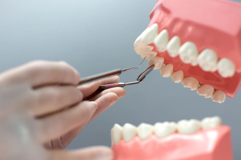 Quais são os Nomes dos Dentes ?