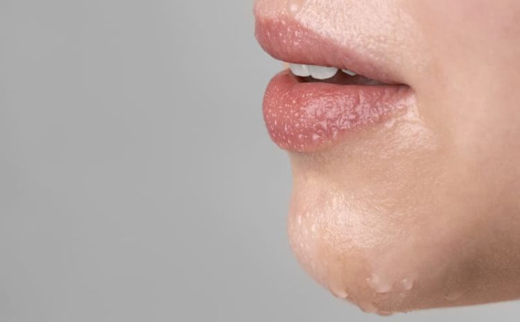  Ressecamento Labial e Odontologia – Dicas da Dra. Shirlene Oliveira para Cuidar do Seu Sorriso