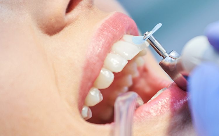  Limpeza Dental Dra. Shirlene Oliveira: 7 Benefícios Que Você Precisa Conhecer