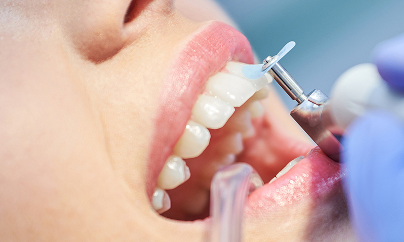 Limpeza Dental Dra. Shirlene Oliveira: 7 Benefícios Que Você Precisa Conhecer
