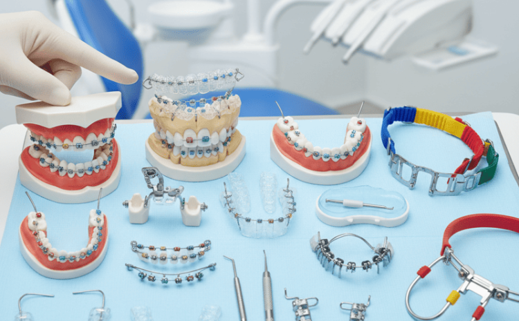  Preços Aparelhos Dentários no Brasil: 7 Valores Atualizados