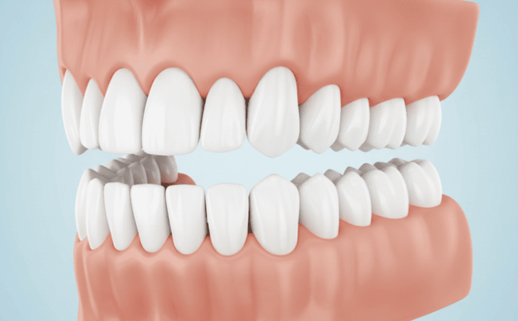  Quais os nomes dos dentes? Veja os 4 tipos e suas funções