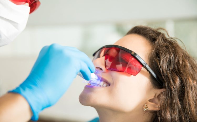  Clareamento dental em Campinas | Dra. Shirlene Oliveira Dentista Especialista