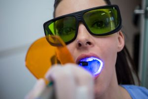 Limpeza Dental Profissional