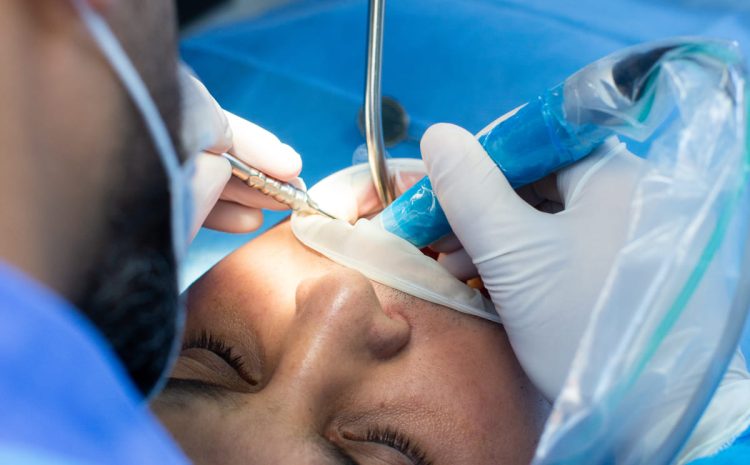  Cirurgia do Siso em Campinas: Quando Fazer, Preço, Recuperação e Cuidados