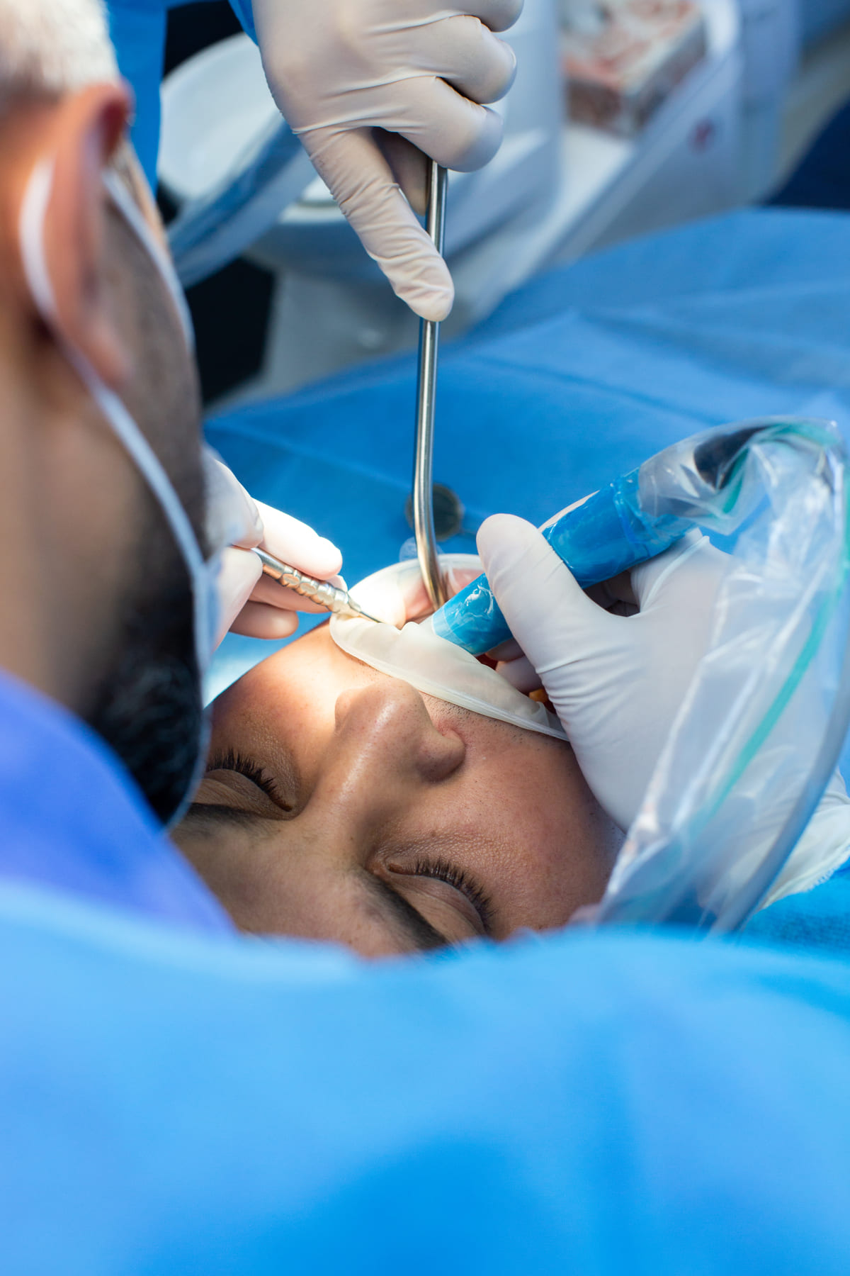 Cirurgia do Siso em Campinas: Quando Fazer, Preço, Recuperação e Cuidados