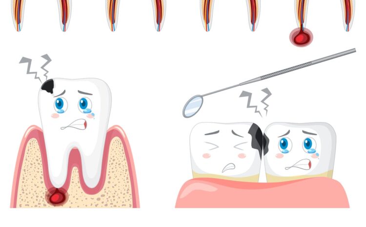  Como Evitar Fraturas Dentárias: 10 Dicas para Proteger Seus Dentes