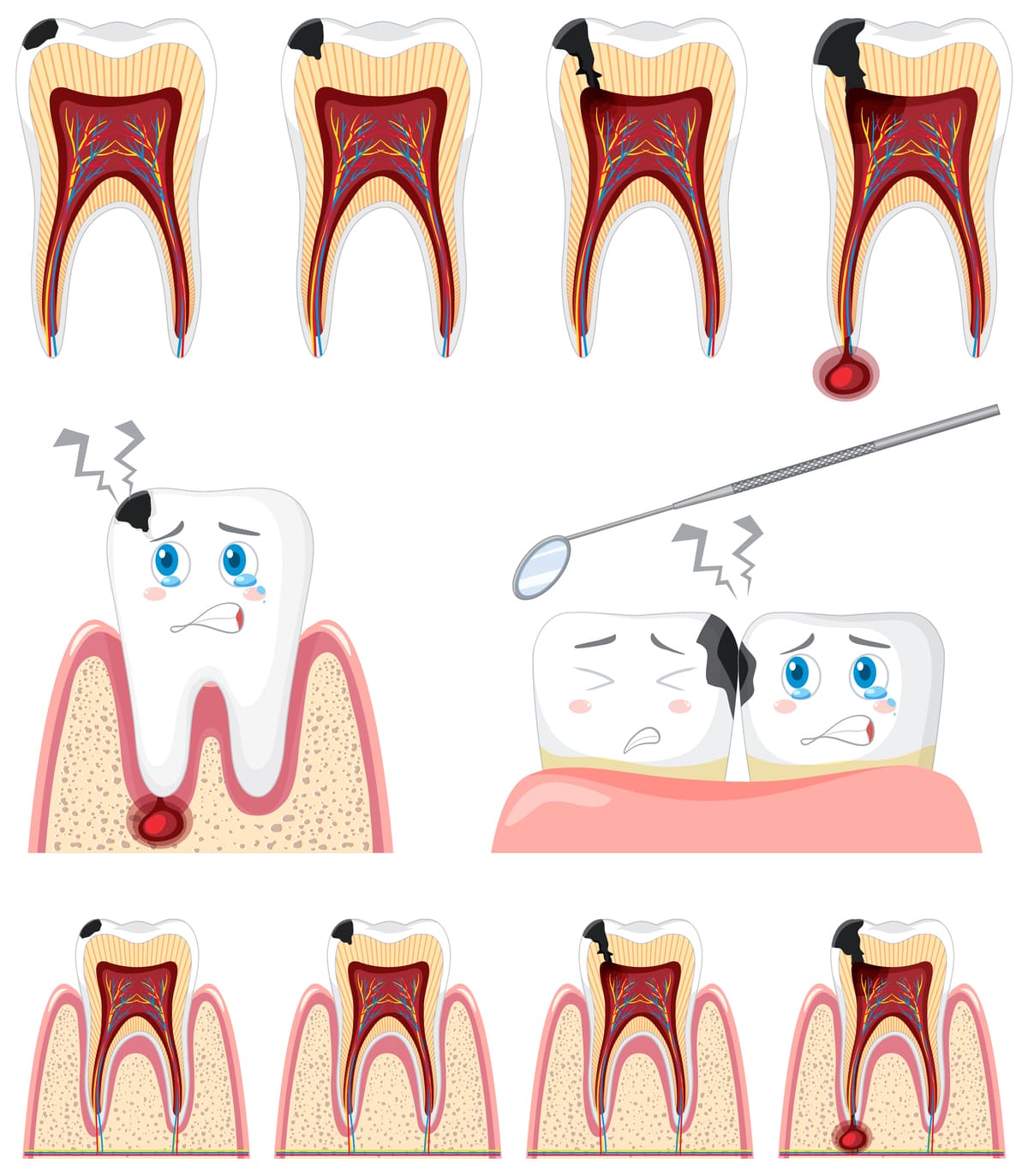 Como Evitar Fraturas Dentárias: 10 Dicas para Proteger Seus Dentes