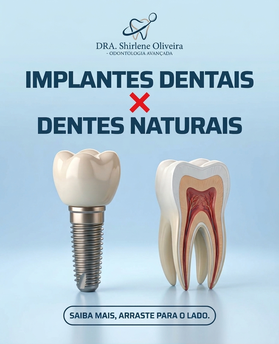 Implantes Dentais x Dentes Naturais: Por Que Preservar o Dente é Sempre a Primeira Opção