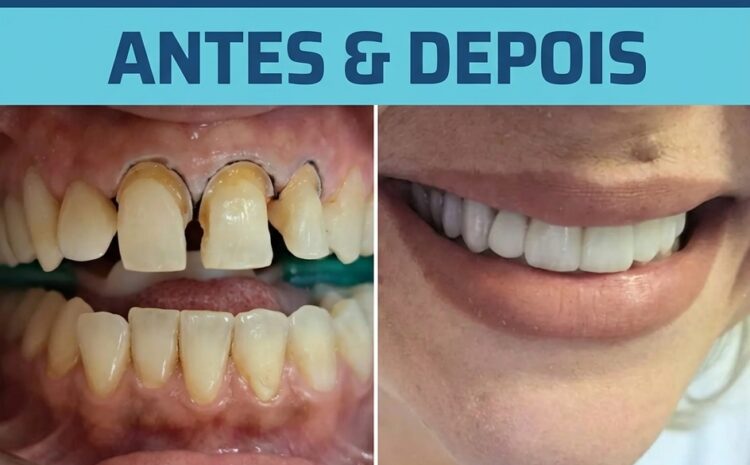  Tratamento Estético Dental: quando cuidar do sorriso também transforma a autoestima