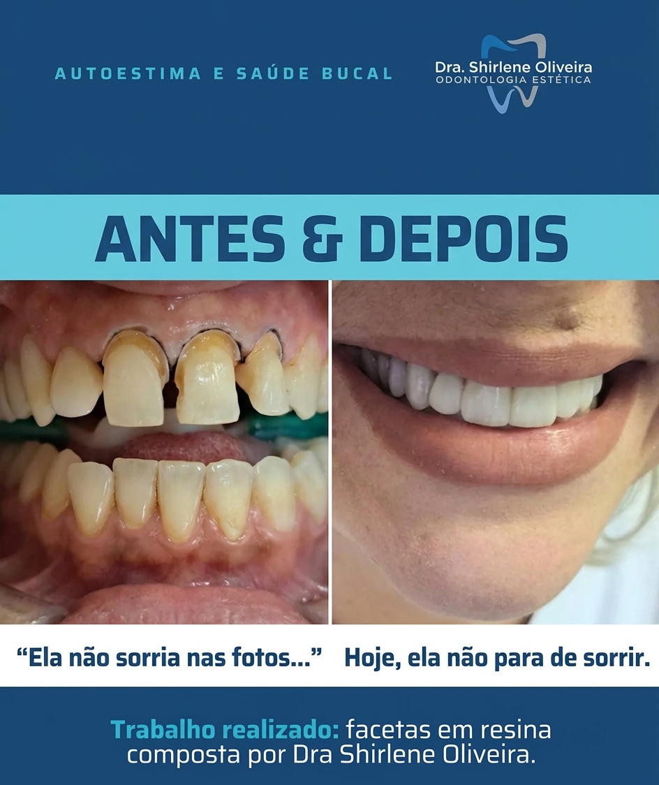 Tratamento Estético Dental: quando cuidar do sorriso também transforma a autoestima