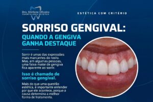 Sorriso Gengival