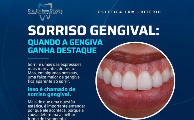  Sorriso Gengival: 7 Causas e Como Tratar
